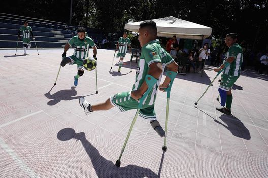 Jugadores del equipo de fútbol de amputados Peña Bética El Salvador, entrenan hoy en las instalaciones de la Ciudad Deportiva Inclusiva, en San Salvador (El Salvador). EFE/Rodrigo Sura Morso del serpente e gamba amputata: Magdalena, 17 anni, in Europa grazie al Betis- immagine 3