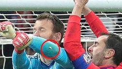 VIDEO – Godin perde tre denti per un’uscita di Neto: che pugno!