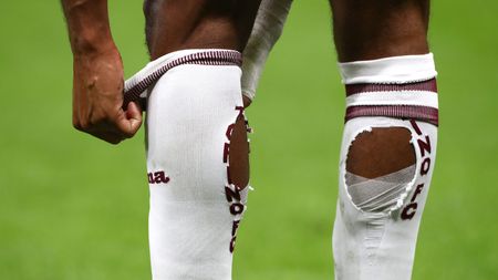 MILAN, ITALY - OCTOBER 26: A detailed view of holes cut in the socks of Koffi Djidji of Torino FC are seen during the Serie A match between AC Milan and Torino FC at Stadio Giuseppe Meazza on October 26, 2021 in Milan, Italy. (Photo by Marco Luzzani/Getty Images)