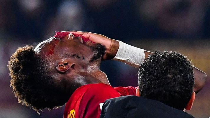 AS Roma's British forward Tammy Abraham receives assistance after being injured during the Italian Serie A football match between AS Roma and Hellas Verona, on February 19, 2023 at the Olympic stadium in Rome. (Photo by Tiziana FABI / AFP) (Photo by TIZIANA FABI/AFP via Getty Images) ? FOTO – Abraham dopo il colpo all’occhio: “Grazie dei messaggi, starò bene” - immagine 1