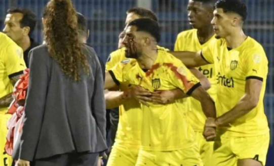 Libertadores, l’ex Fiorentina Maxi Olivera colpito al volto da una pietra- immagine 3