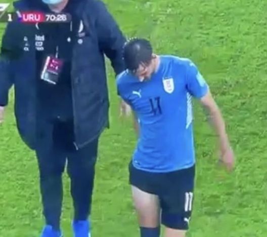 Peru-Uruguay, infortunio per Vina: si teme una lesione Peru-Uruguay, infortunio per Vina: si teme una lesione