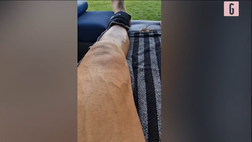 VIDEO Milan, Ibrahimovic dopo l’intervento: come va la riabilitazione al ginocchio