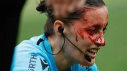 Guardalinee ferita, terribile post sessista di un preside: “Se restava a casa…”