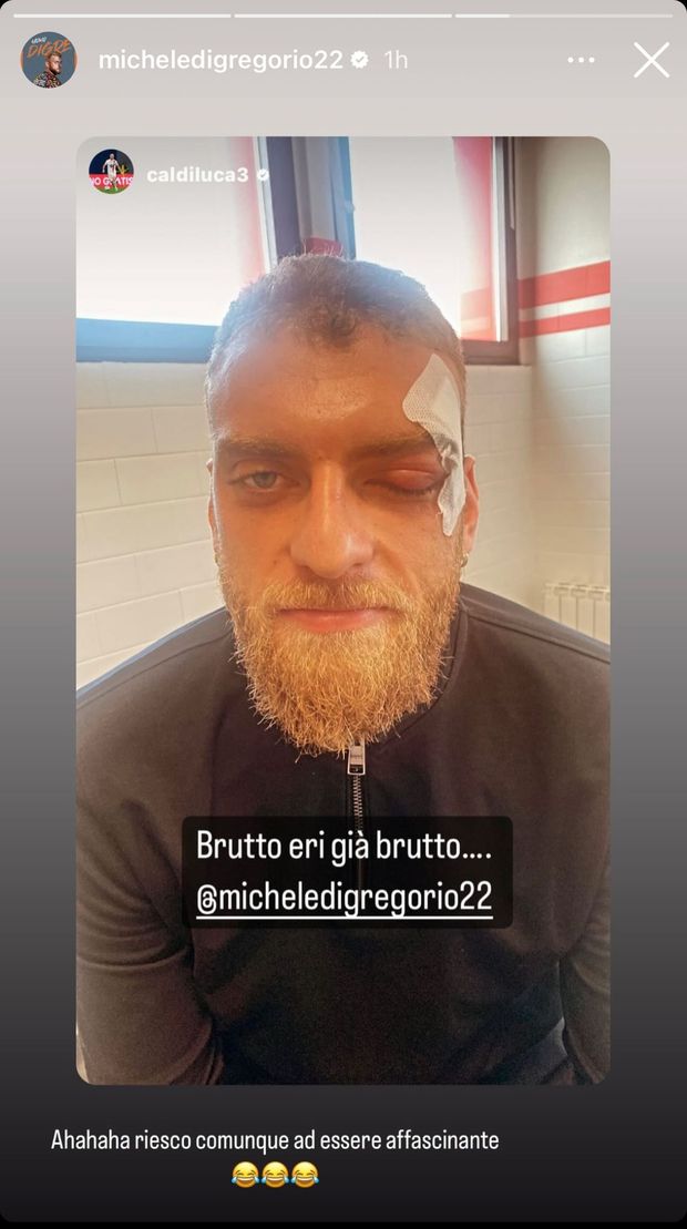 FOTO – Di Gregorio, la botta alla testa e il grande spavento- immagine 2