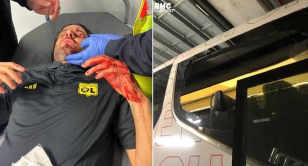 Ex Verona, Fabio Grosso ferito dai tifosi del Marsiglia. OM-Lione non si gioca- immagine 2