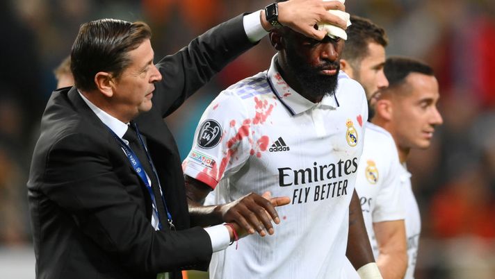 WARSAW, POLAND - OCTOBER 11: Antonio Rudiger of Real Madrid is seen injured after clashing with Anatoliy Trubin of Shakhtar Donetsk (not pictured) during the UEFA Champions League group F match between Shakhtar Donetsk and Real Madrid at Wojska Polskiego Stadium on October 11, 2022 in Warsaw, Poland. (Photo by Adam Nurkiewicz/Getty Images) Ancelotti: “Rudiger ha solo un taglio profondo al sopracciglio, ma quanto sangue! Voleva tornare in campo…” - immagine 1