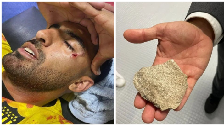 Libertadores, l’ex Fiorentina Maxi Olivera colpito al volto da una pietra - immagine 1