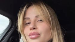 Lady Hernandez si difende dopo l’operazione al seno: “Non fate domande se poi non…”