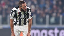 Juventus, per Higuain operazione alla mano e niente Napoli