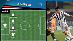 VIDEO Lazio-Juventus: Sarri senza Immobile, Allegri perde Dybala. Le probabili
