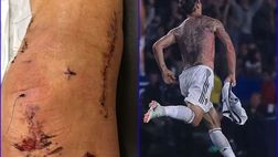 Ibrahimovic sull’infortunio: “Mi avevano detto che era finita. Ma io ho detto no”