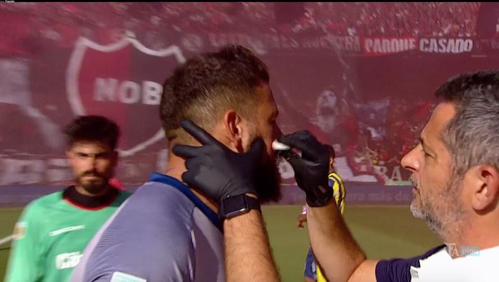 Rosario, il portiere ferito ha dato l’ok a giocare il derby: “Altrimenti sarebbe stato tutto rinviato” - immagine 1