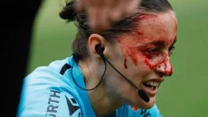 Guardalinee ferita, terribile post sessista di un preside: “Se restava a casa…” - immagine 1